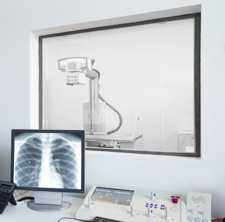 Röntgen chrbtice - hlavná metóda diagnostiky osteochondrózy
