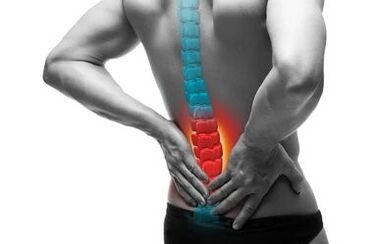 Osteochondróza je ochorenie chrbtice