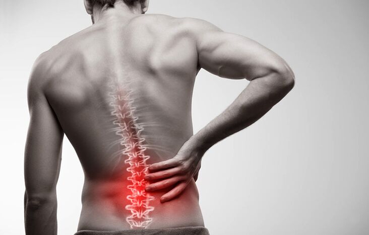 bolesť v dolnej časti chrbta v dôsledku osteochondrózy